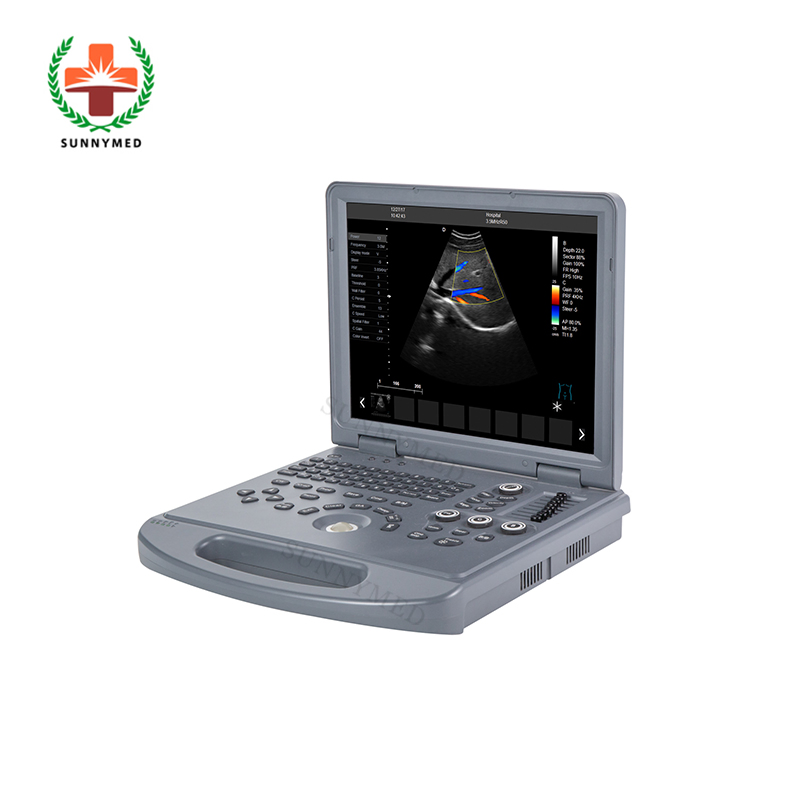 Sy-A024A Máquina de ultrasonido Doppler color para ginecología, obstetricia y vascular en venta