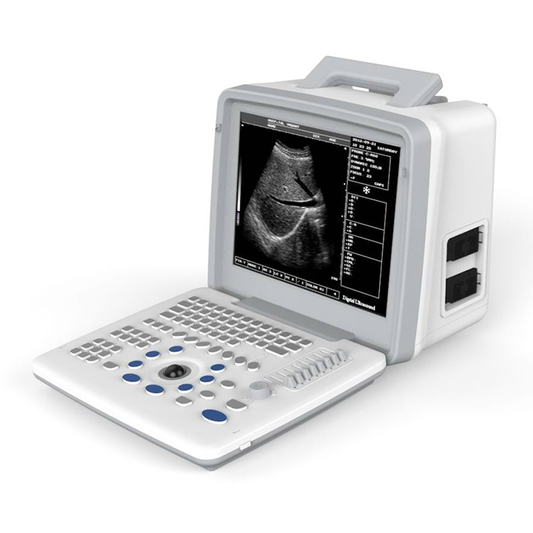 Ubw300 Máquina de ultrasonido portátil humana de bajo precio para instrumentos médicos