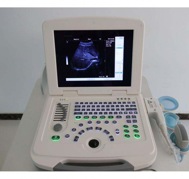 Escáner ultrasónico diagnóstico portátil humano obstétrico ginecológico barato para laptop