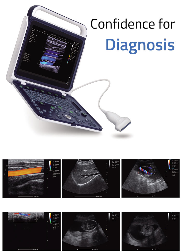 My-A027e Equipos de Diagnóstico Médico Abdomen Urología Máquina de Ultrasonido Portátil