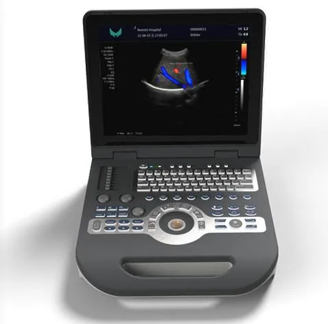 Xf3500 Portátil 4D Escáner