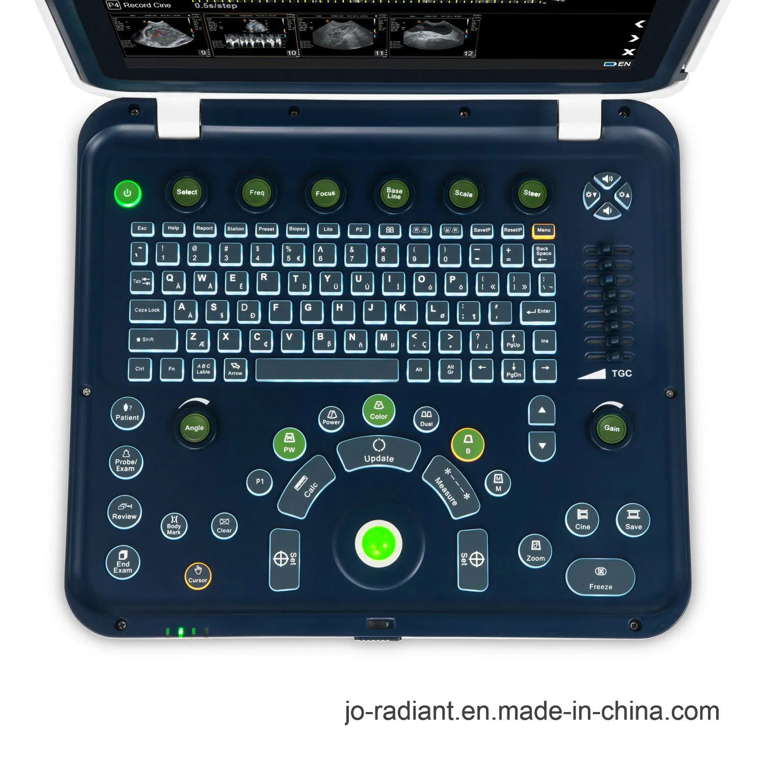 Sistema de escáner ultrasónico Doppler color portátil