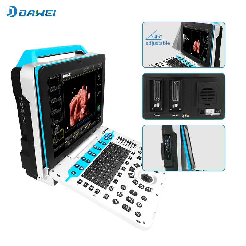 Máquina Médica de Ultrasonido Color Portable Doppler3d 4D