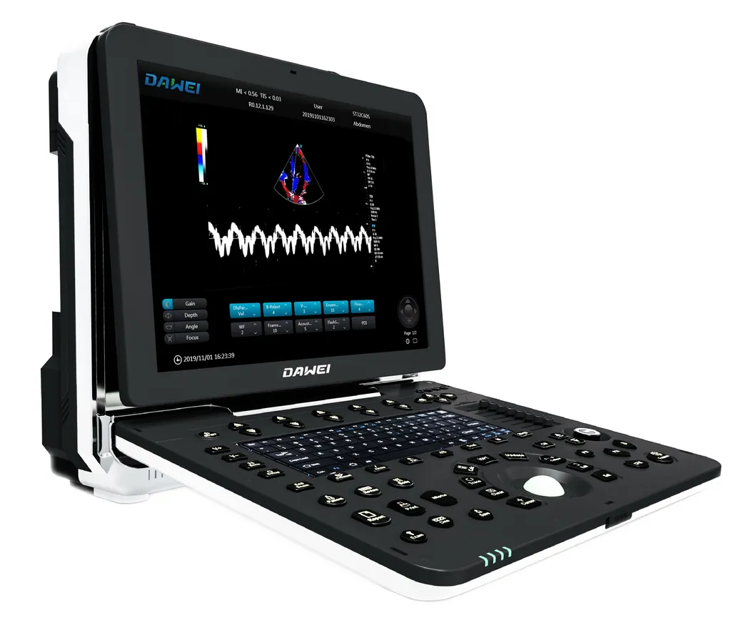 Sistema de Doppler Color Ultrasonido