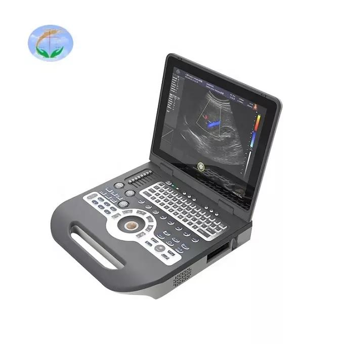 Sistema de Doppler Color PW para Ginecología y Obstetricia, Máquina de Ultrasonido Portátil, Escáner de Ultrasonido