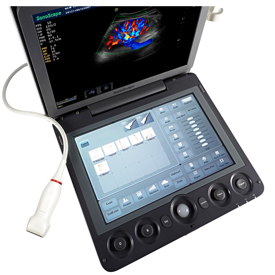 Escáner de Ultrasonido Doppler Color Vascular Cardíaco Portátil 3D 4D