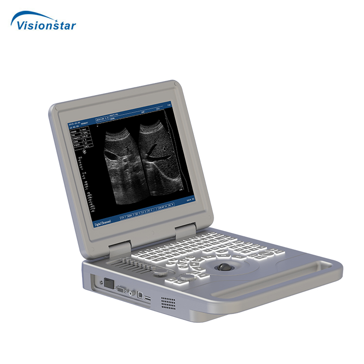 Ubm70A Equipo de Obstetricia Ginecología Verificar Máquina de Ultrasonido Portátil en Blanco y Negro