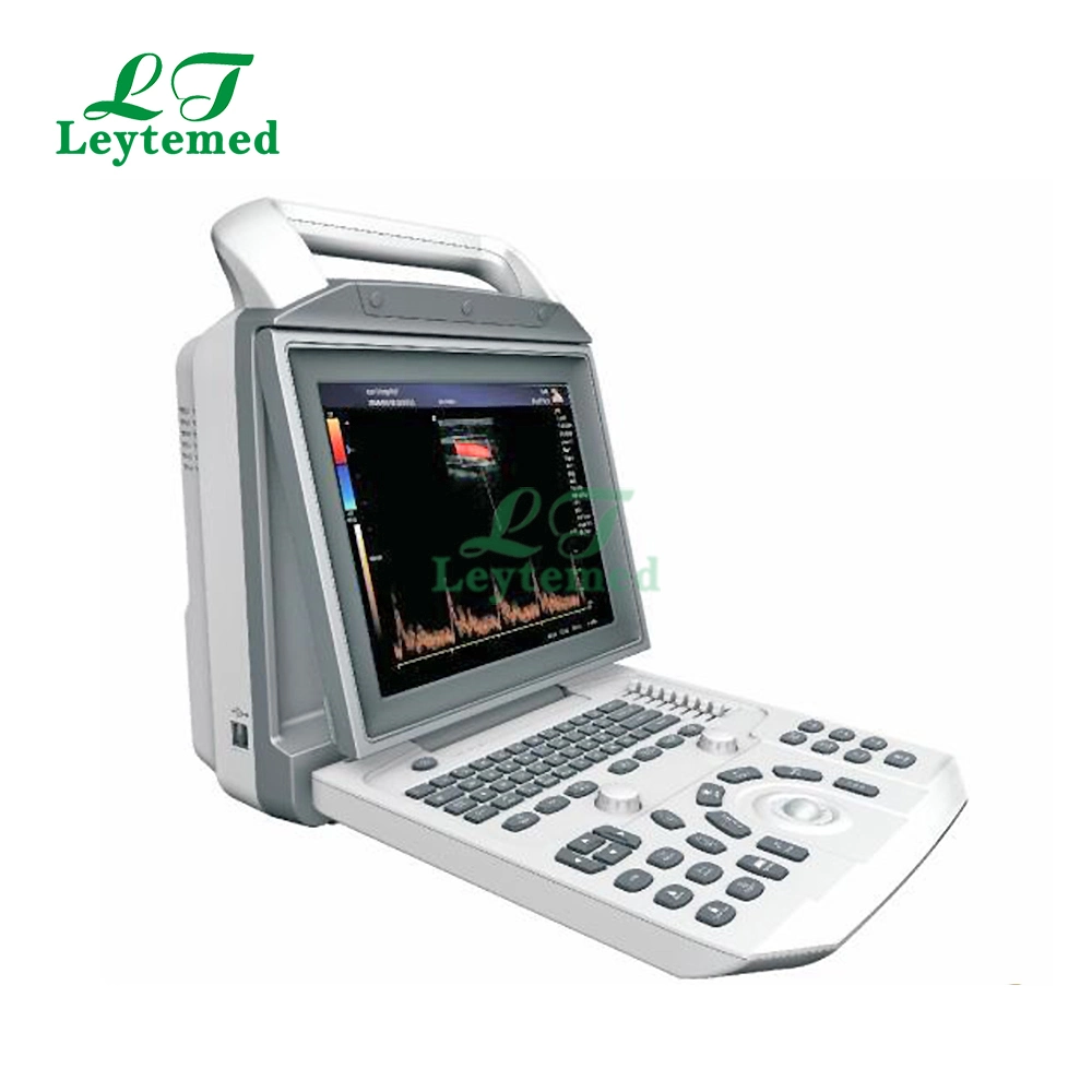 Ltub06 Todo Sistema de Diagnóstico Cardíaco Abdominal Digital por Ultrasonido con Doppler Color