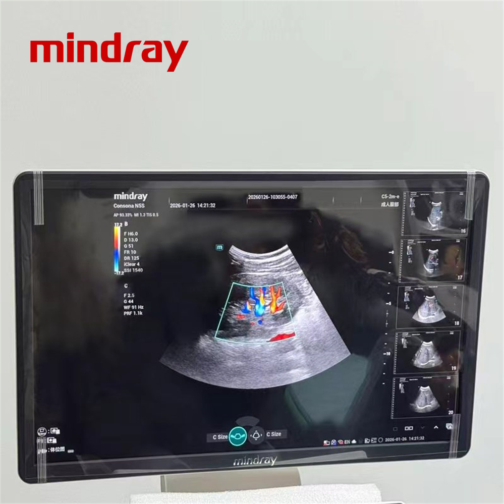 Máquina de Ultrasonido Médico 3D 4D Ultrasonido Tolley Mindray N5 N5s N6 N7 N8 DC26 DC28 Escáner de Ultrasonido Doppler Color Mindray Máquina de Escaneo por Ultrasonido