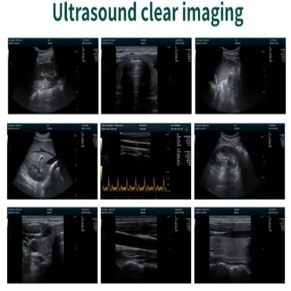 Escáner portátil de ultrasonido veterinario detallado