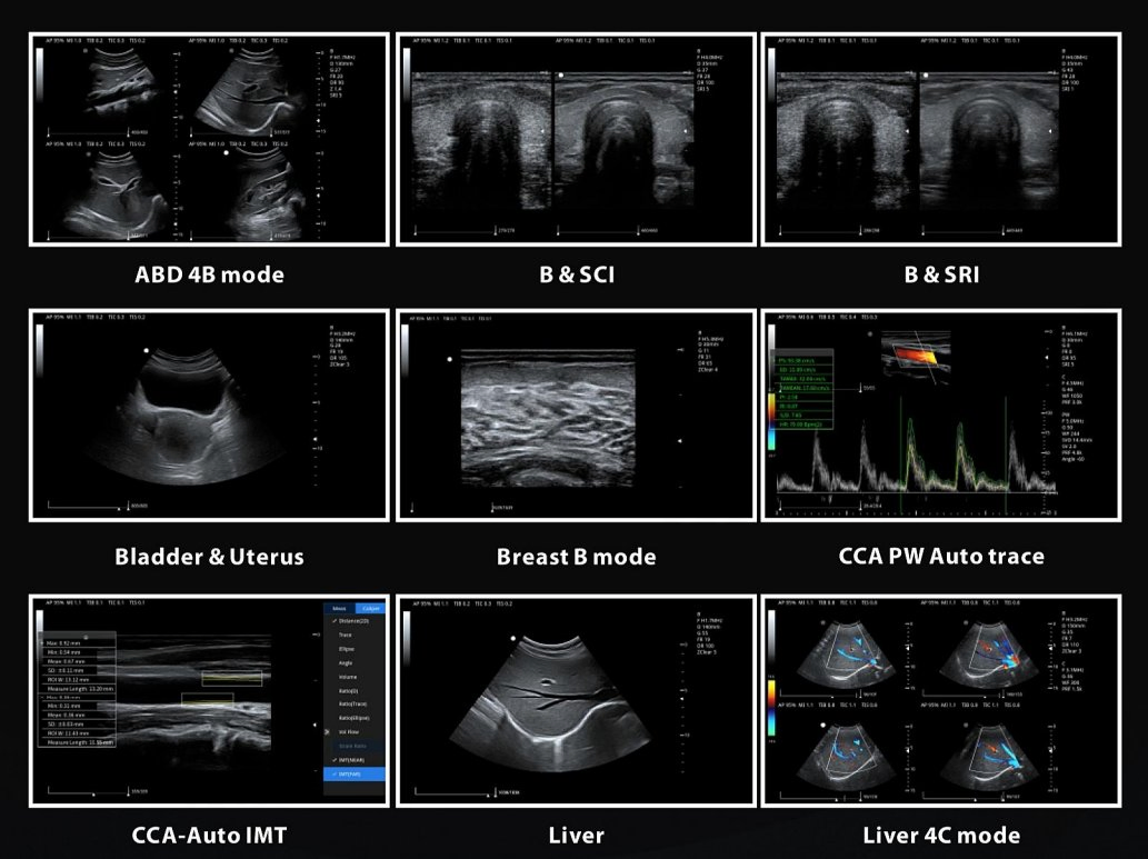 Sya-N7 Abdomen, Cardíaco 3D/4D Sistema de Ultrasonido Doppler Color con Carro