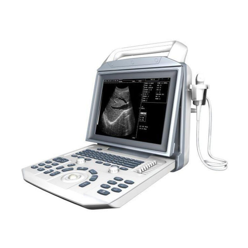 Sistema de diagnóstico ultrasónico hospitalario portátil, económico y de buena calidad, máquina de ultrasonido en blanco y negro para el embarazo