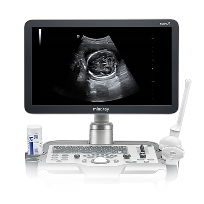 Sistema de Ultrasonido Doppler Color Avanzado Umdc-30 para Clínicas Umdc-26
