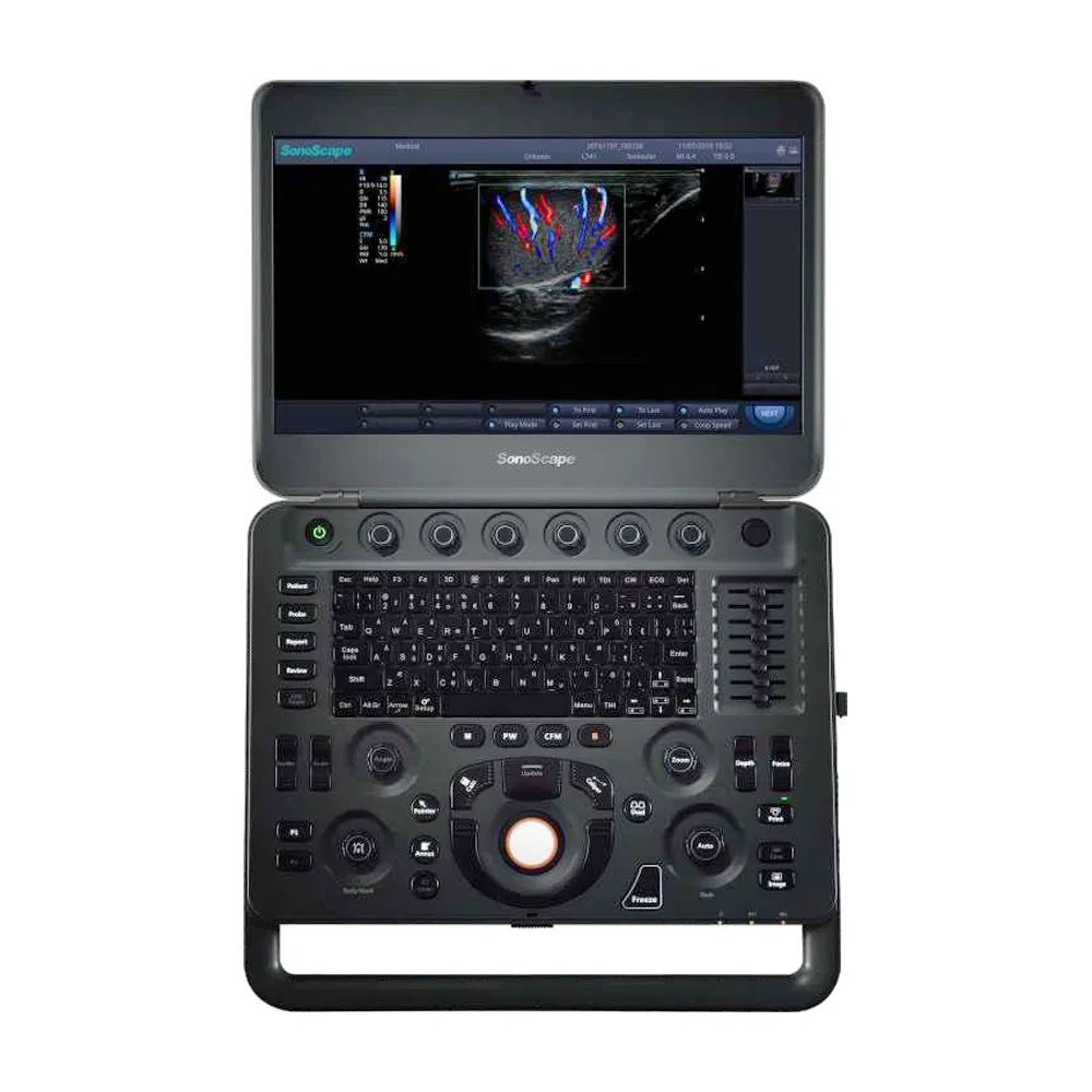 Sistema de Ultrasonido Doppler Color Digital Portátil Sonoscape X5 en Venta Caliente 4D