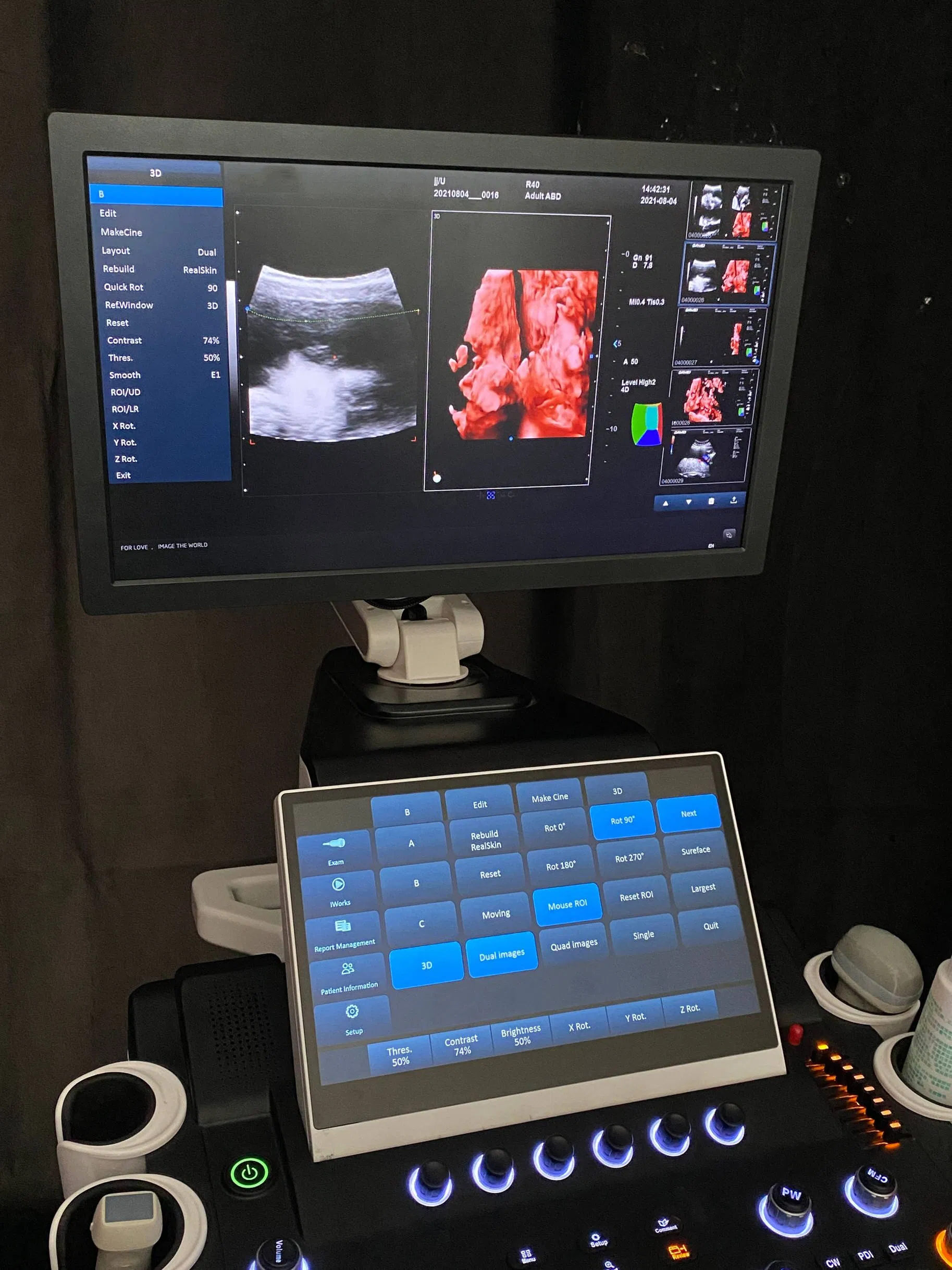 Instrumentos médicos profesionales de ultrasonidos con aprobación CE e ISO 3D 4D 5D máquina de ultrasonido Doppler color Trolley