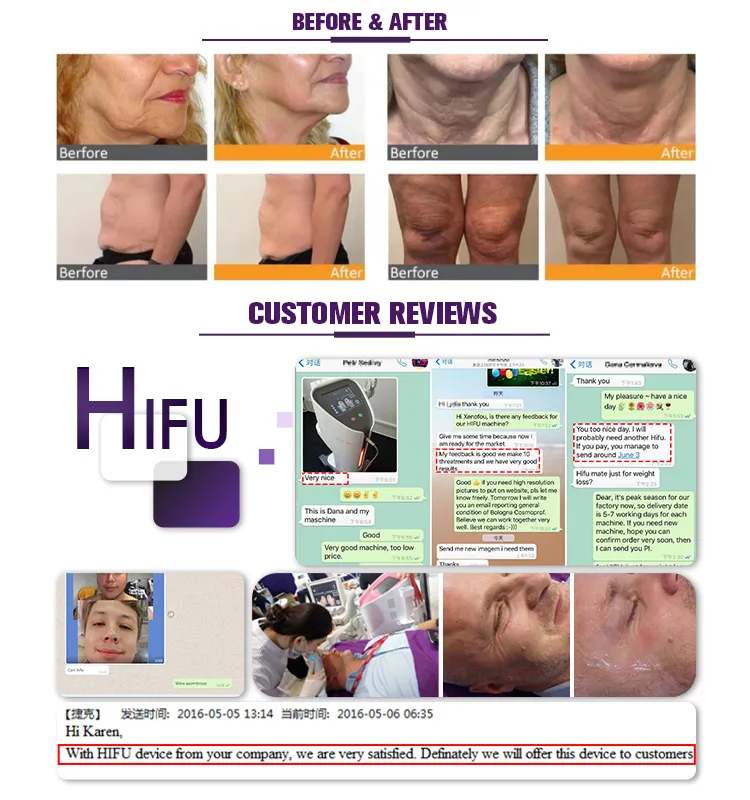 Customer Results