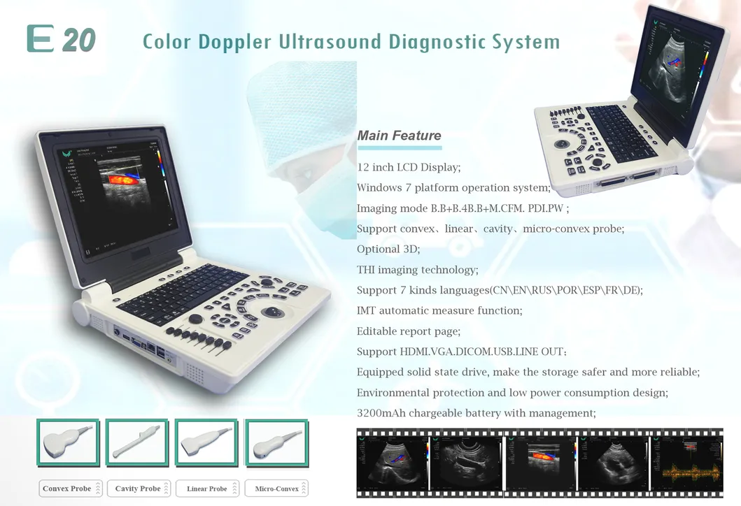 Sistema Ultrasonografía E20