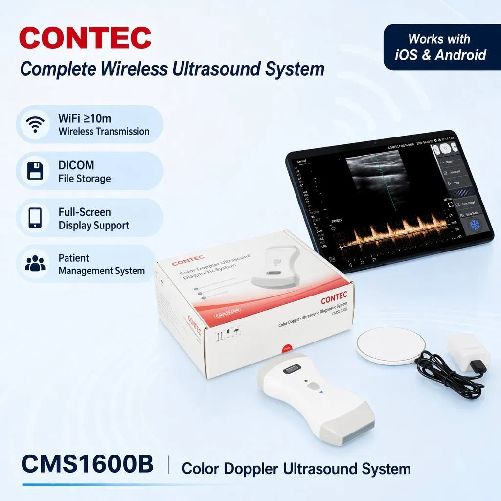Contec Cms1600b Escáner de ultrasonido portátil inalámbrico con sonda Doppler color aprobado por Salud Canadá