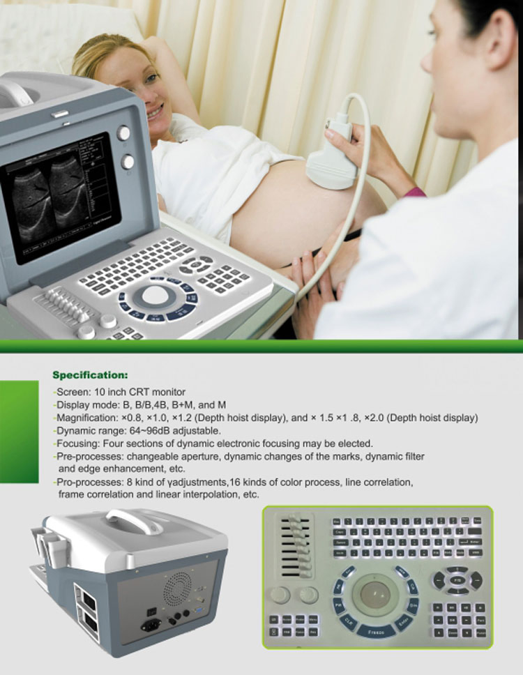 My-A001A Equipo de diagnóstico médico barato máquina de ultrasonido portátil