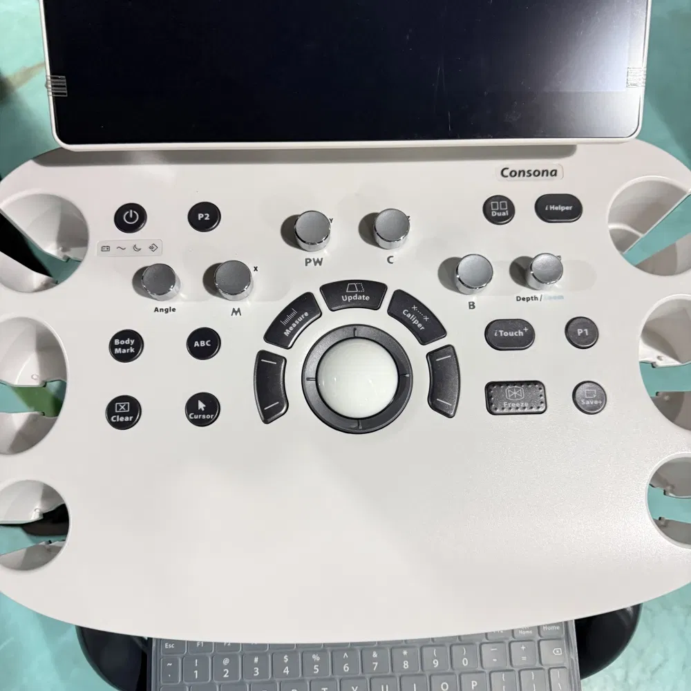 Máquina de Ultrasonido Doppler Color Mindray Consona N7 Cardiovascular Obstetricia Ginecología Urología