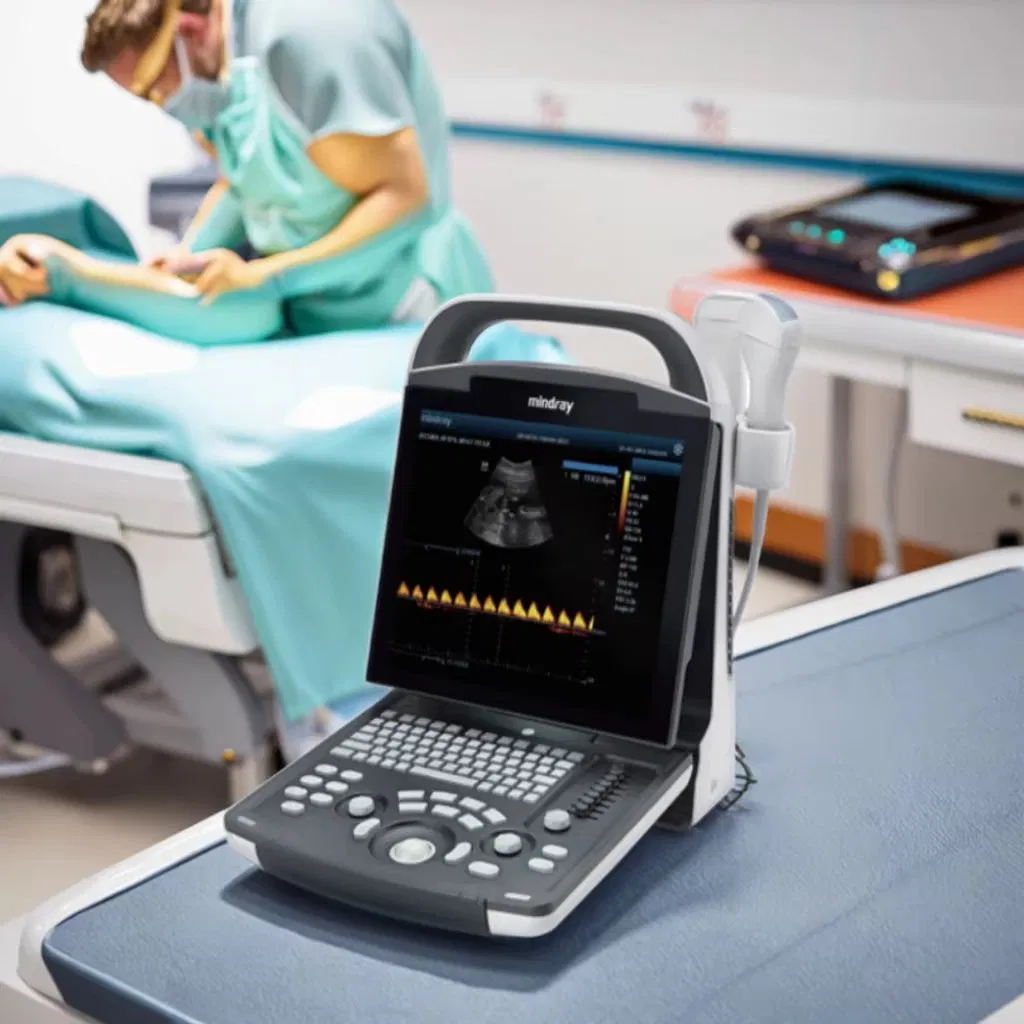 Sistema de Máquina de Ultrasonido Portátil Cardiovascular Obstetricia Ginecología Urología Máquina de Escáner de Ultrasonido