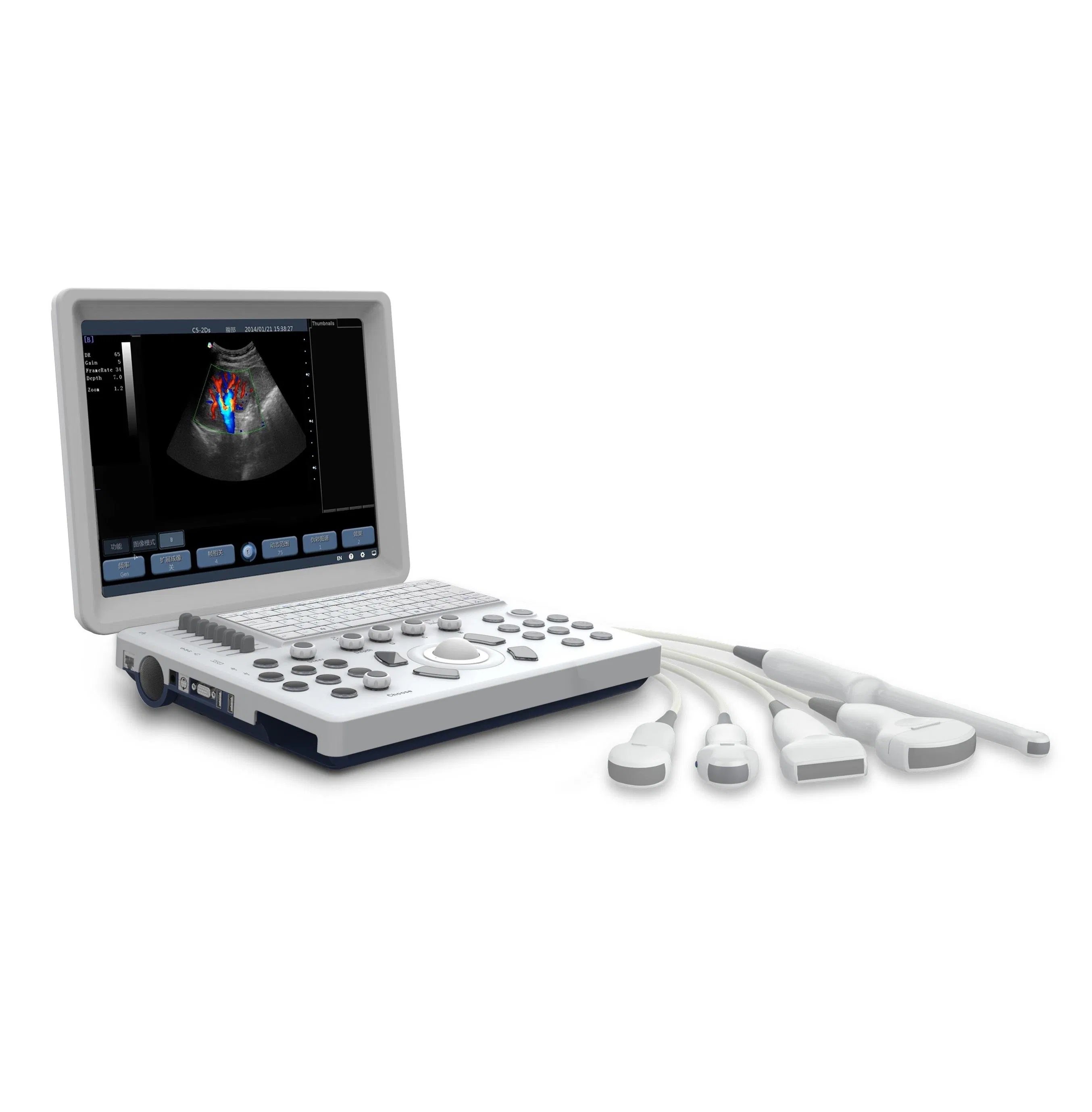 Sistema de diagnóstico por ultrasonido Doppler color digital completo veterinario