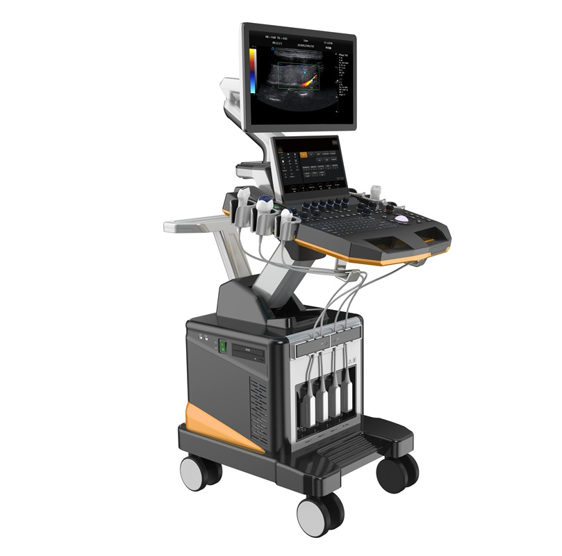 Sistema de ultrasonido Doppler color tipo carro de alta gama: imágenes avanzadas para diagnóstico de abdomen, obstetricia y ginecología, cardíaco y vascular