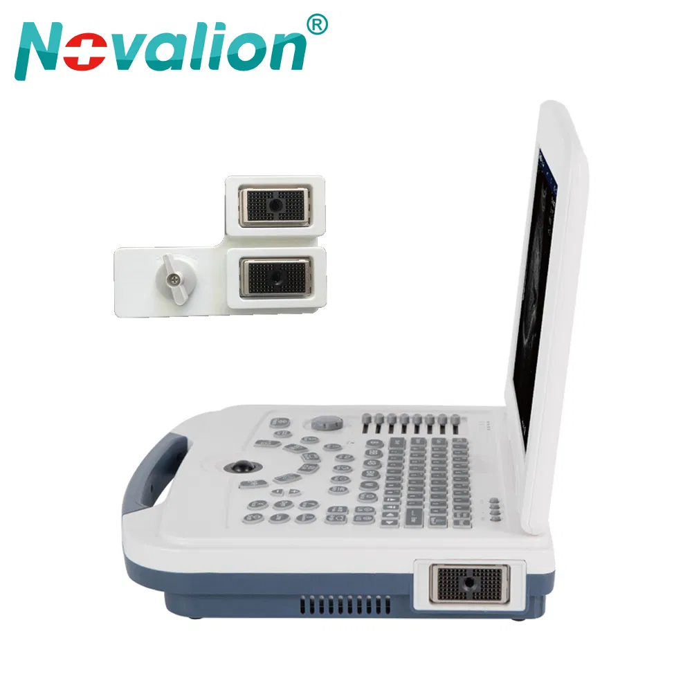 Precio de fábrica al por mayor Nl060701004A 12.1 Pulgadas Pantalla Médica 2D Máquina de Ultrasonido Portátil en Blanco y Negro