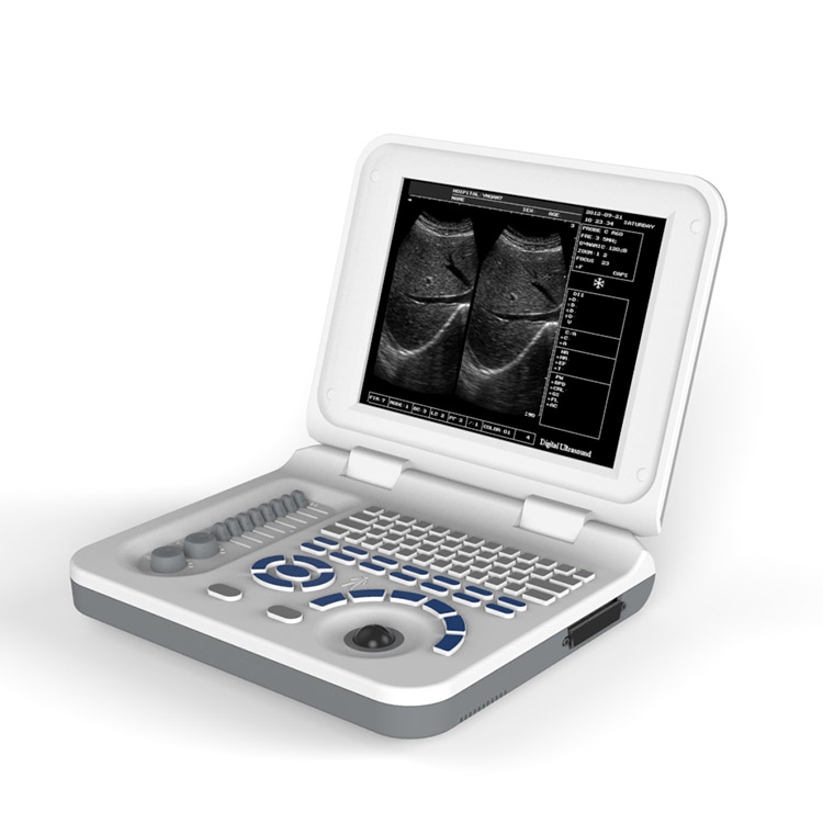 Ubw30 Escáner de ultrasonido vascular portátil en blanco y negro para humanos