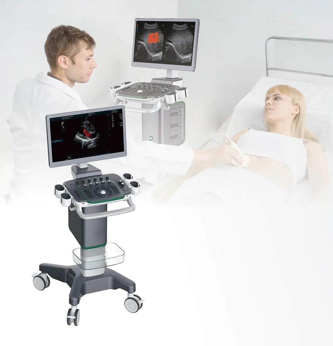 Dispositivo de Ultrasonido Médico de Imagen Digital Avanzada 4D Sistema de Diagnóstico Doppler Color Visual