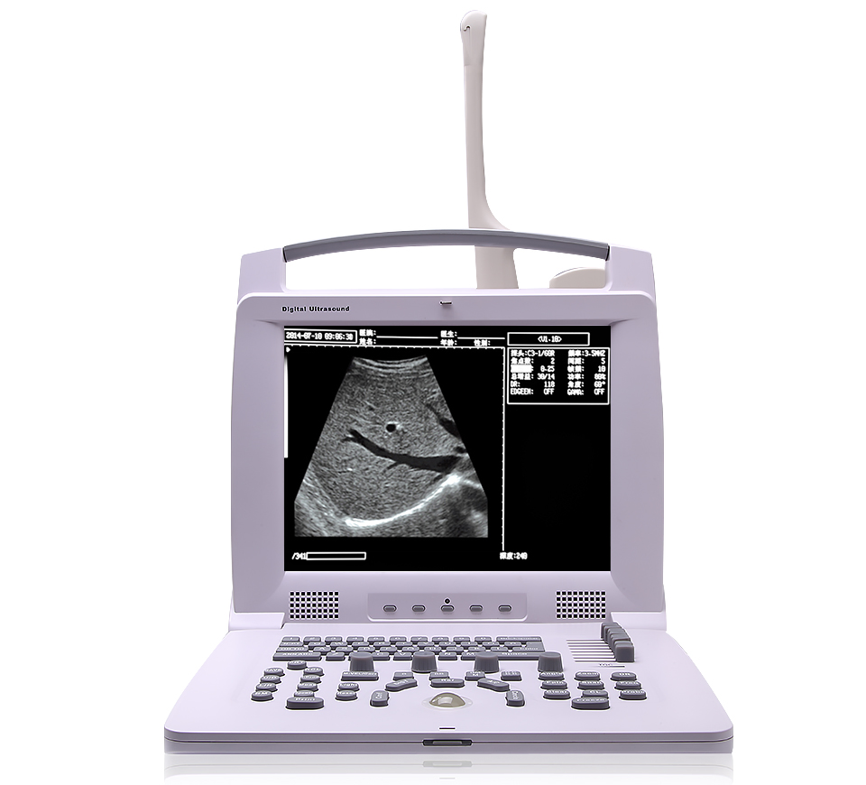 Máquina de ultrasonido portátil de pantalla grande para diagnóstico con control de sonda de equipo hospitalario