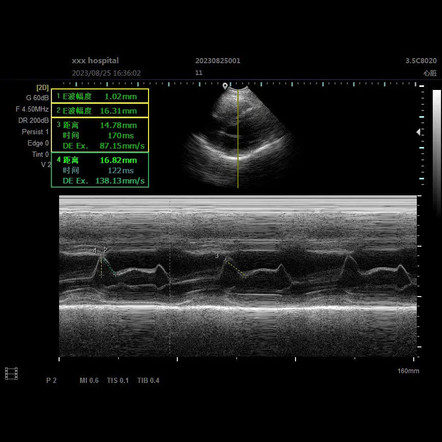 Diagnóstico por ultrasonido Doppler 3