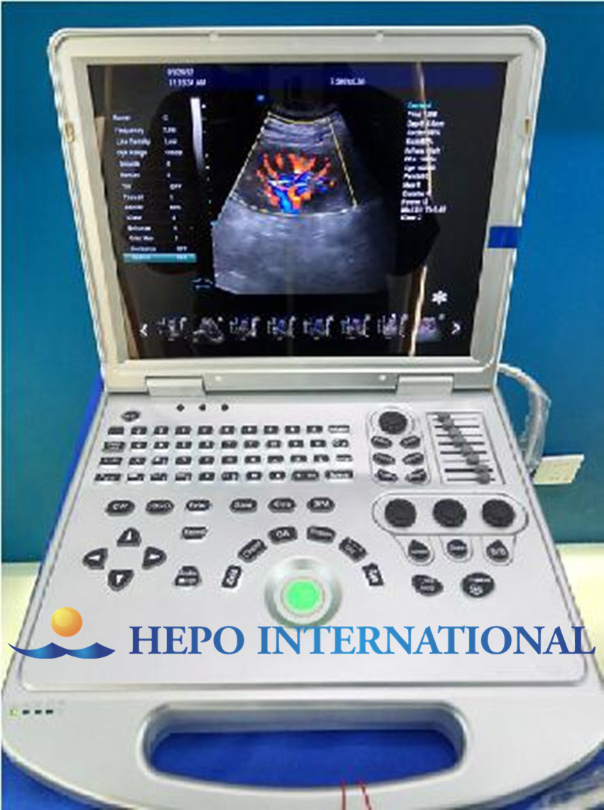 Sistema de escáner ultrasónico Doppler color portátil popular ruso 2D 3D