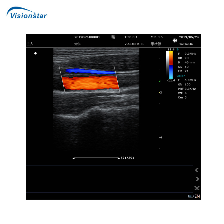 Carro de diagnóstico ultrasónico de tipo Doppler color con sondas de proveedor de fábrica