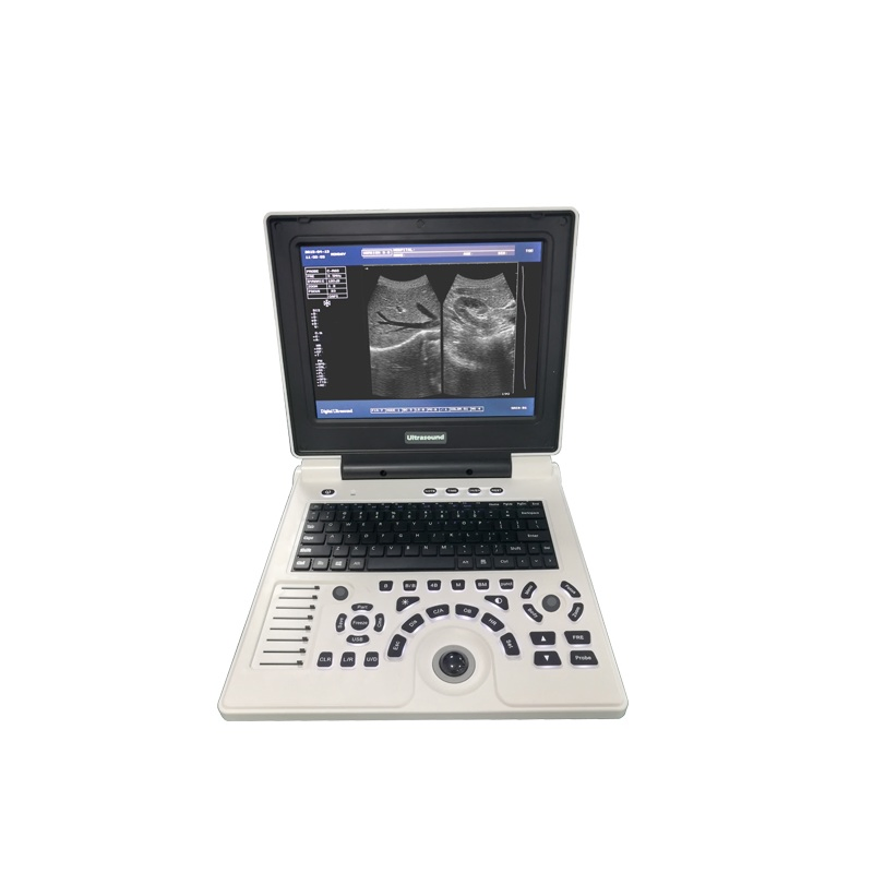 Sistema de ultrasonido portátil 15-Inch de estilo cuaderno LCD en blanco y negro con sondas de múltiples frecuencias