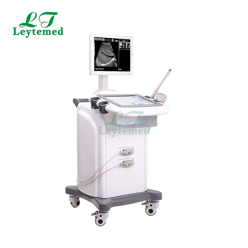 Ltub28 Máquina de ultrasonido móvil Doppler de trolley para vejiga, cardíaca y renal en blanco y negro