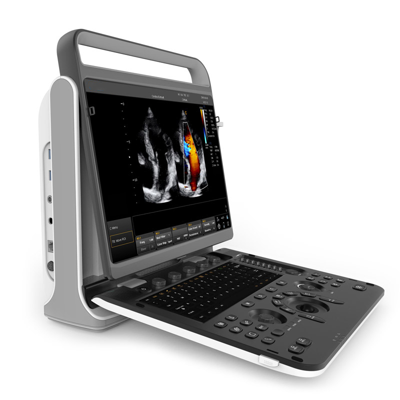 Sistema de Imagenología Diagnóstica Digital de Doppler Color Portátil Chison Ebit30 4D 5D para Ultrasonido Humano en Ginecología y Ecocardiografía Cardiovascular