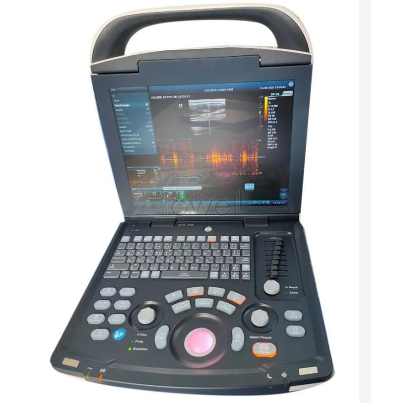Máquina de Ultrasonido Digital Veterinario Mindray Dp20 para Granja y Veterinaria