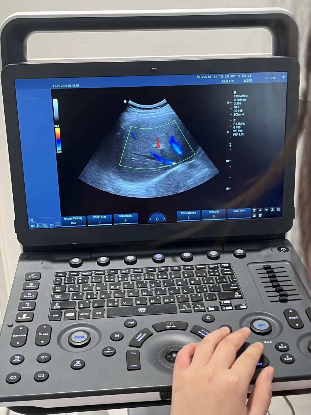 Análisis de Imagen 3