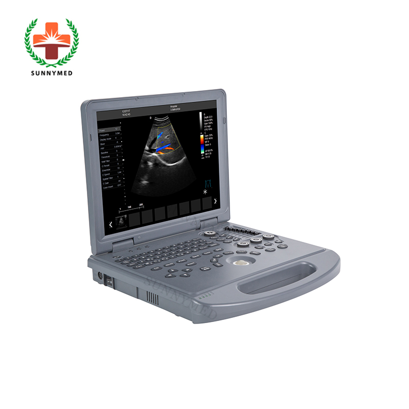 Sy-A024A Máquina de ultrasonido Doppler color para ginecología, obstetricia y vascular en venta