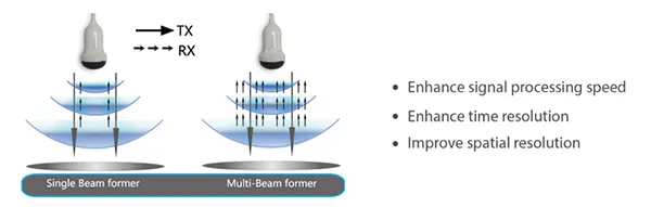 Tecnología de Ultrasonido