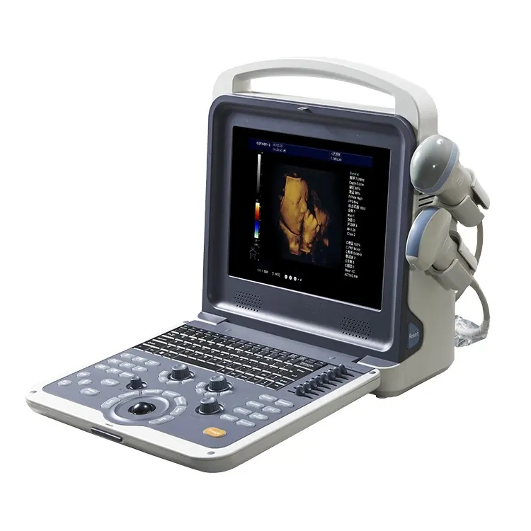 Escáner de ultrasonido B portátil digital completo a color Doppler médico 4D