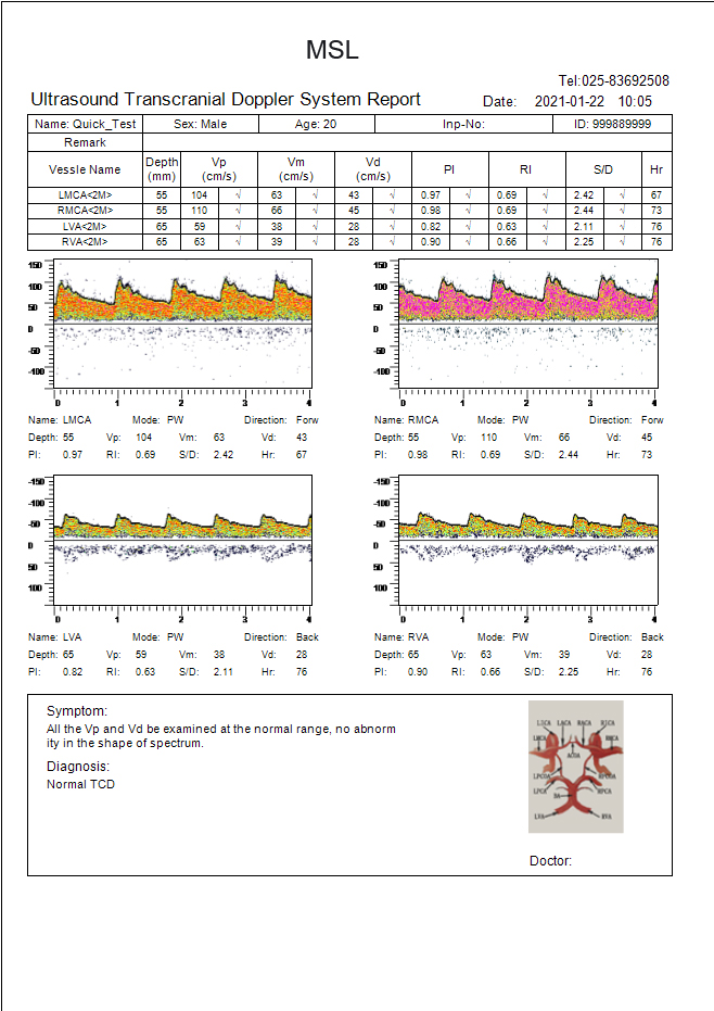 Sistema de ultrasonido Doppler transcraneal Tcd para la detección de vasos intracraneales y del cuello, canal único, cuatro profundidades