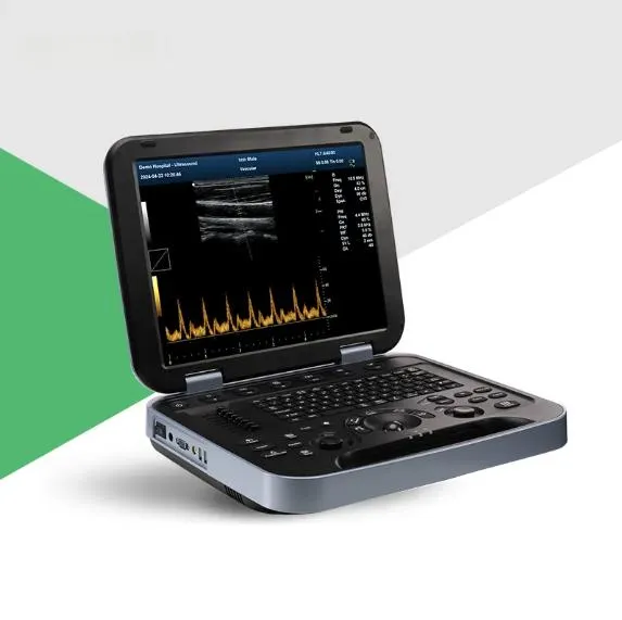 Sistema de Ultrasonido Doppler Color Avanzado 15 Pantalla LCD Médica de 3D 4D Pulgadas