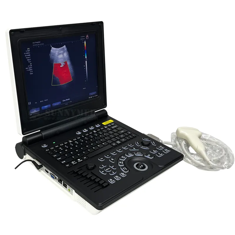 Diagnóstico Doppler 2
