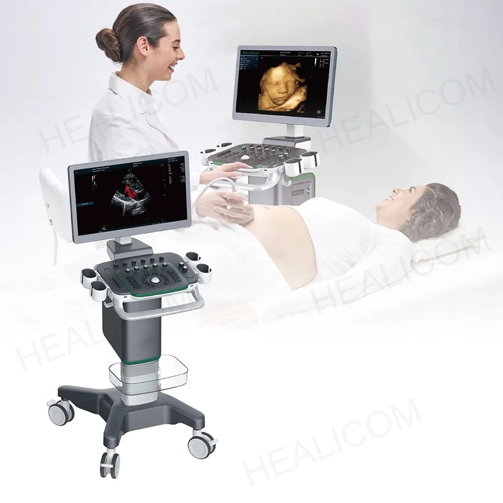 Sistema de Ultrasonido Médico con Doppler Color Digital de Alta Resolución 4D Escáner de Imágenes en Tiempo Real con Pantalla Doble
