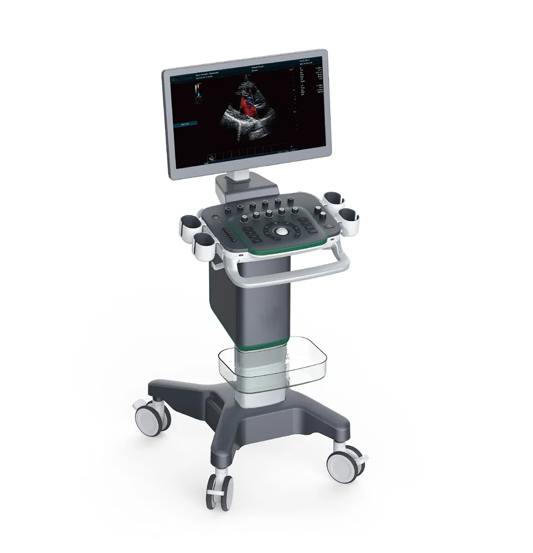 Dispositivo de Ultrasonido Médico de Imagen Digital Avanzada 4D Sistema de Diagnóstico Doppler Color Visual