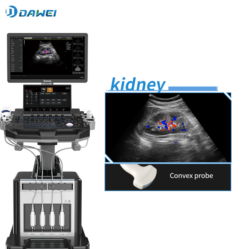 4D Máquina de ultrasonido clínico con Doppler color