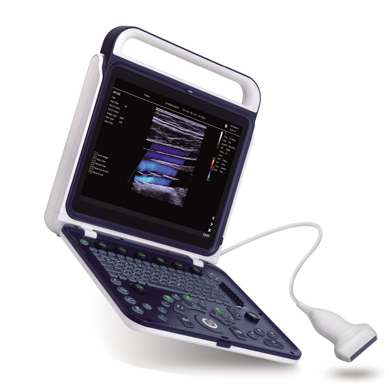 My-A027e Equipos de Diagnóstico Médico Abdomen Urología Máquina de Ultrasonido Portátil