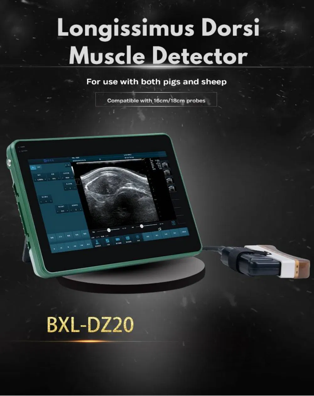 Sistema de Ultrasonido Doppler